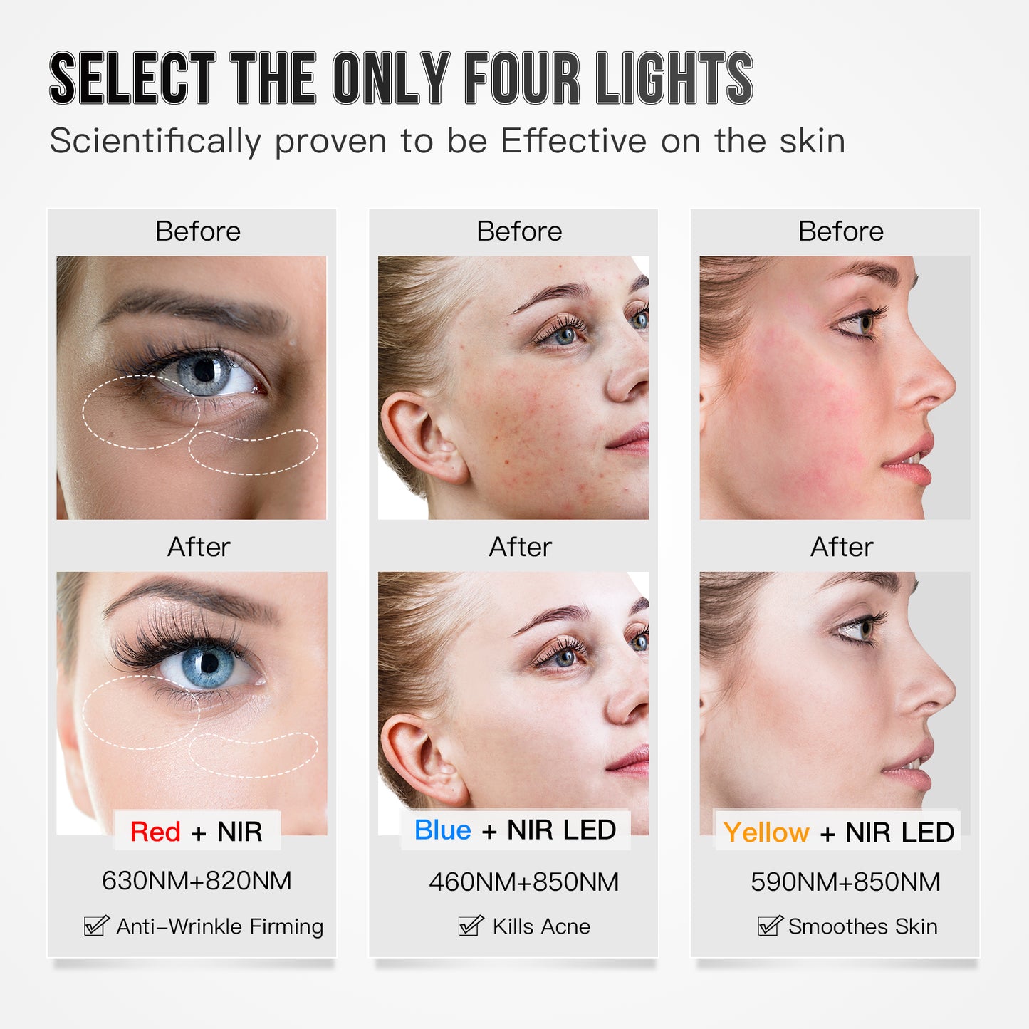 LED Therapie Masker - 3 kleuren